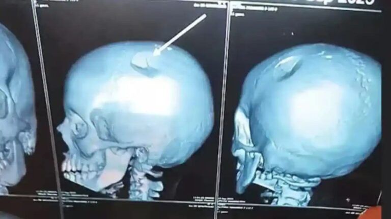 N6814672461758157715194ab690ce4140f8a21f5d0fd4eb46ec877bcf9c2a20b41e258dd39aa9c8d225776 768x4326353125822414943278 1